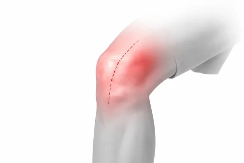 fisioterapia deportiva valencia