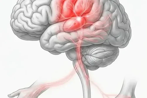 fisioterapia neurologica
