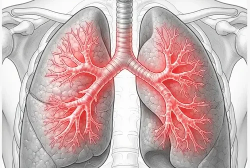 fisioterapia respiratoria