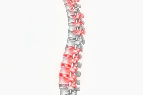 fisioterapia neurologica